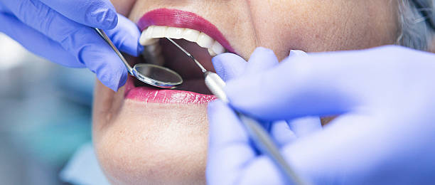 Best Broken or Chipped Tooth Repair in Dundee, MI